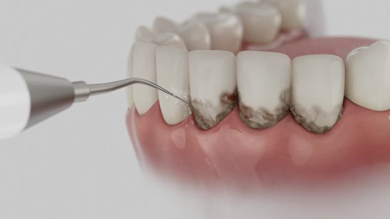 Trusted Tooth Extraction service in Poquoson, VA - Dentist Open Now
